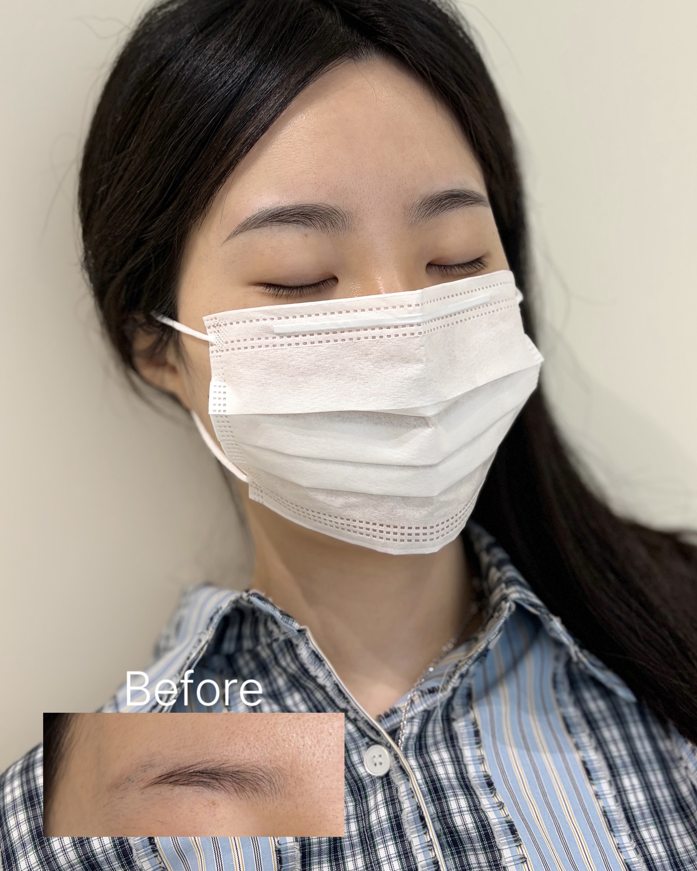 청주눈썹문신 시술 전후 사례